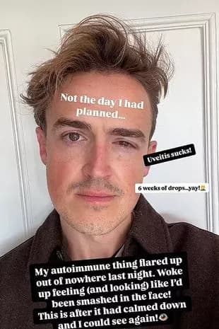 Tom Fletcher